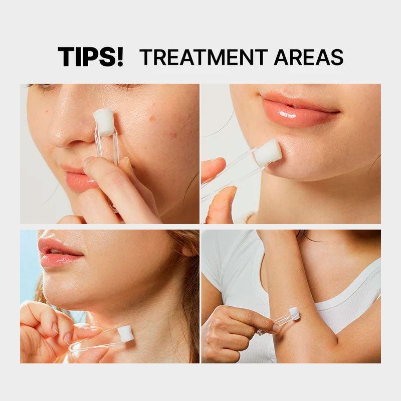 COSRX The AHA 2 BHA 2 Blemish Treatment Serum 120g | Lakinza K - beauty Canada