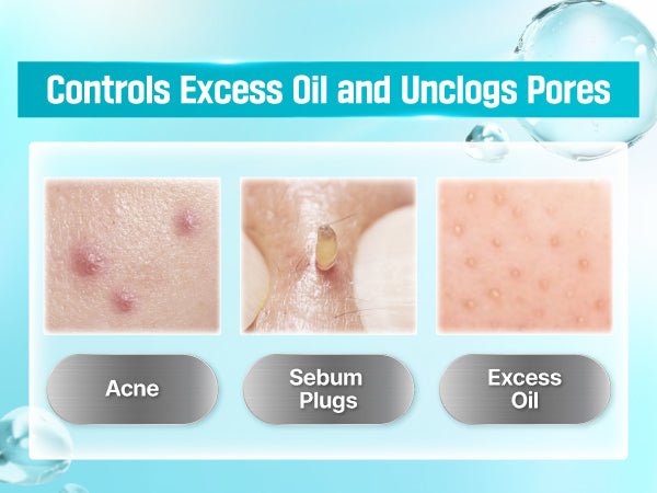 numbuzin No.1 Pantothenic B5 Active Soothing Cream 80ml