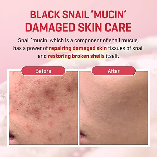 SOME BY MI Snail Truecica Miracle Cream 60g | Lakinza K - beauty Canada
