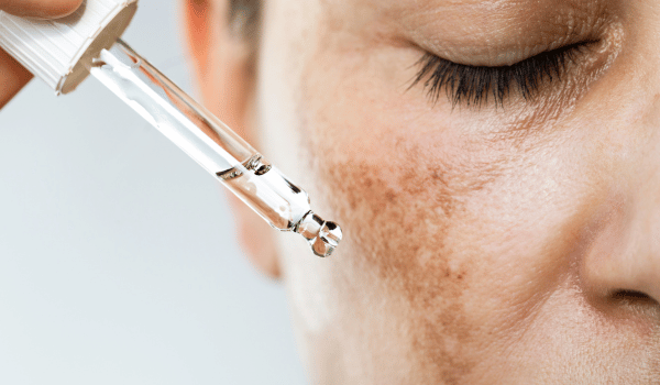 Best Korean Serums for Dark Spots and Hyperpigmentation 2025 - Lakinza K-beauty Canada