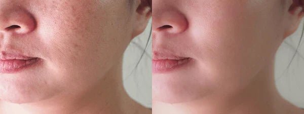 Best Korean Skincare for Dry Skin in Canada - Lakinza K-beauty Canada