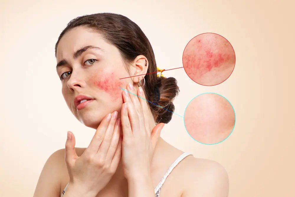 Best Korean Skincare for Sensitive Skin in Canada - Lakinza K-beauty Canada