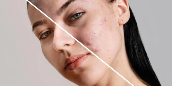 Best Korean Skincare for Sensitive Skin in Canada - Lakinza K-beauty