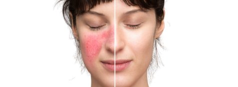 Best Korean Skincare Routine for Dry, Sensitive Skin - Lakinza K-beauty