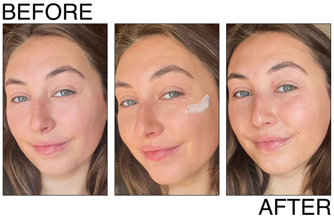 Best Korean Skincare Solutions for Your Skin Concerns in Canada - Lakinza K-beauty