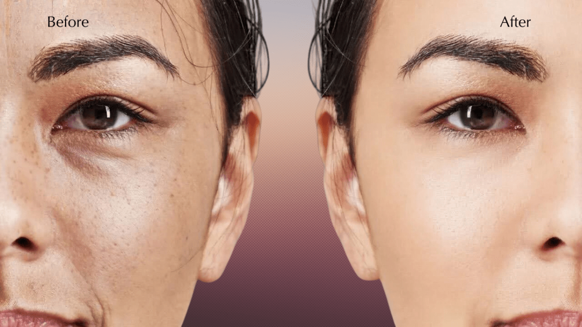 Discover The Anua Naicinamide TXA Dark Spots Brightening Duo - Lakinza K-beauty