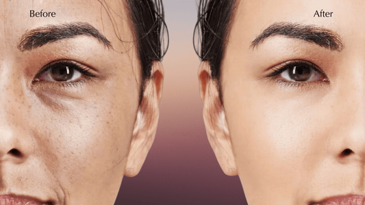 Discover The Anua Naicinamide TXA Dark Spots Brightening Duo - Lakinza K-beauty