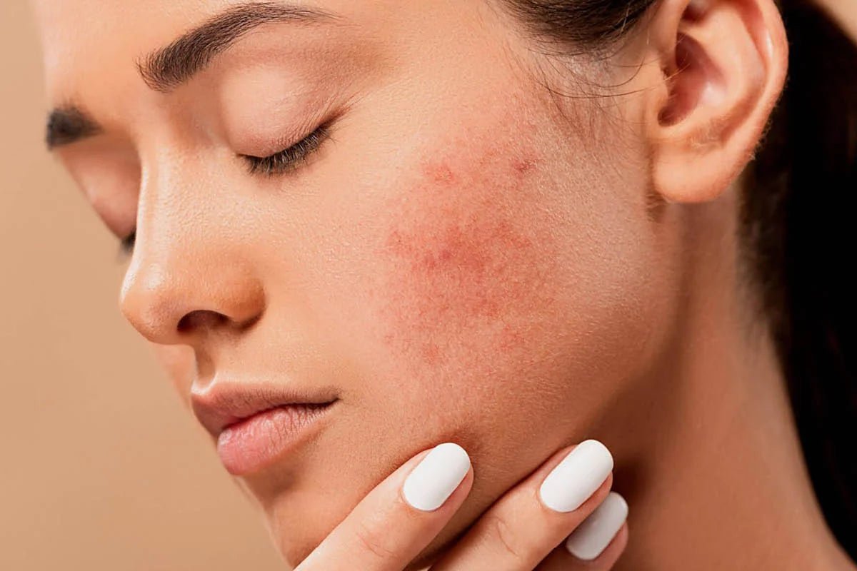 How to Use Korean Skincare for Dry and Sensitive Skin - Lakinza K-beauty