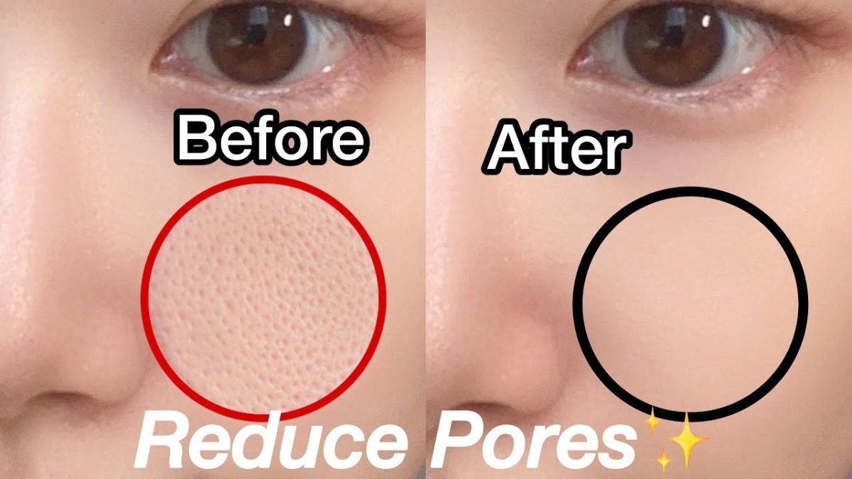 Large Pores: Causes, Solutions, and Best K-Beauty Products - Lakinza K-beauty Canada
