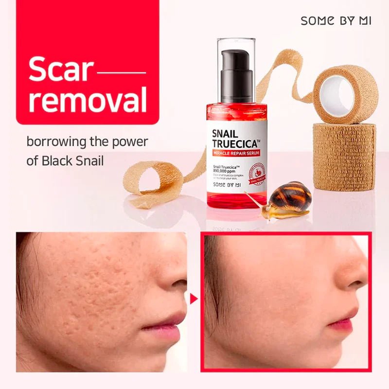 Post-Acne Scar Treatment: A Comprehensive Guide with Some By Mi Snail Truecica - Lakinza K-beauty