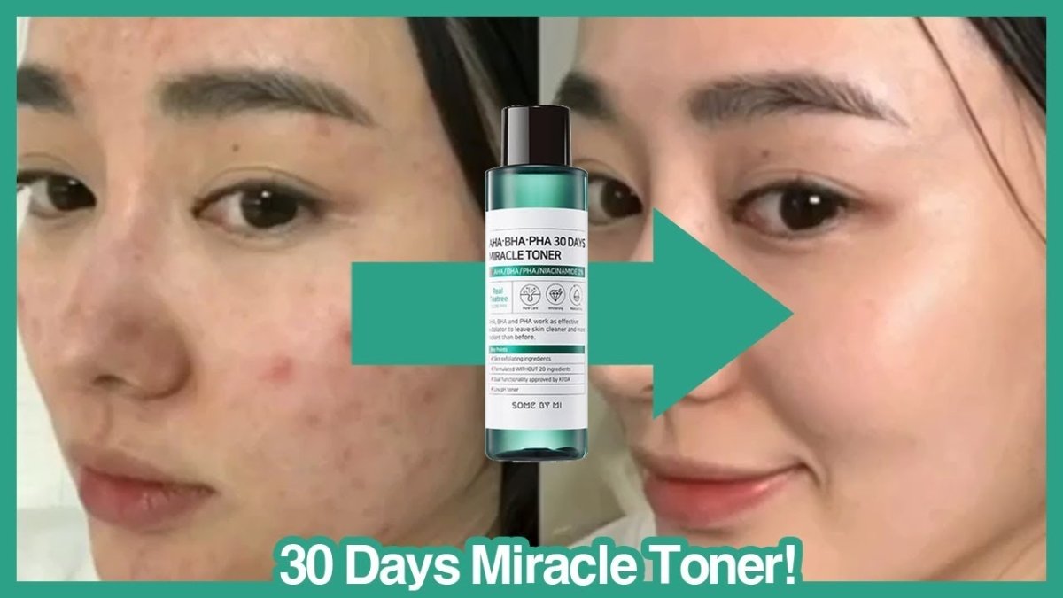 Where to buy SOME BY MI AHA BHA PHA 30 Days Miracle Toner? No.1 Acne Care Toner. - Lakinza K-beauty