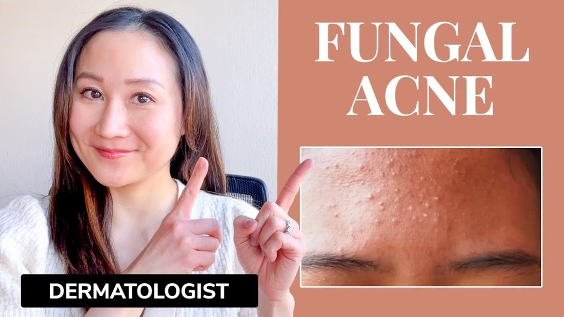 The Ultimate Fungal Acne Safe Korean Skincare Routine - Lakinza K-beauty