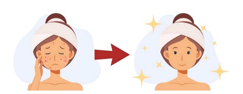 Top Korean Skincare Brands for Acne-Prone Skin in Canada - Lakinza K-beauty