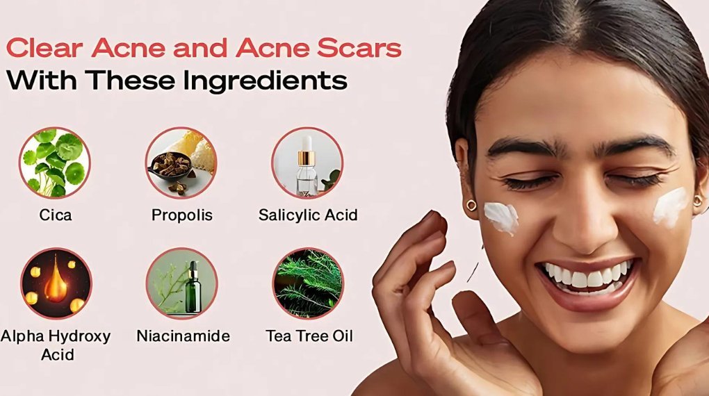 Top Korean Skincare Ingredients for Targeting Acne - Lakinza K-beauty