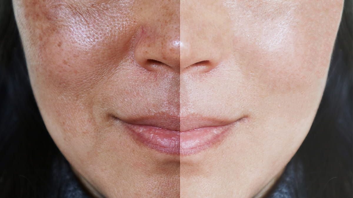 Buy Top Glutathione Korean Skincare Products in Canada - Lakinza