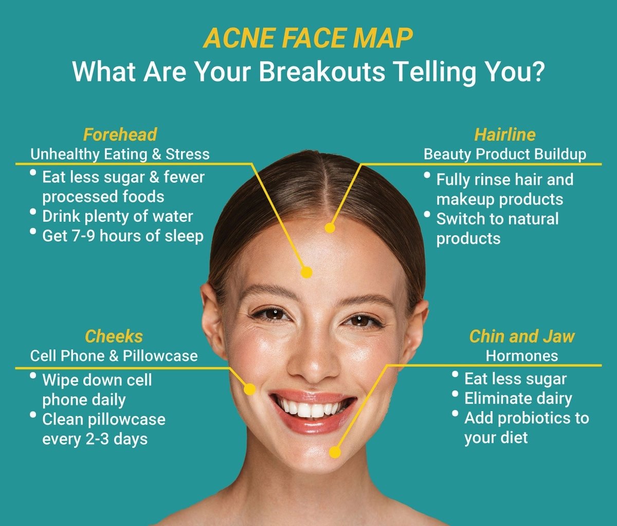 Highest Rated Korean Skincare for Oily & Acne-Prone Skin - Lakinza K-beauty