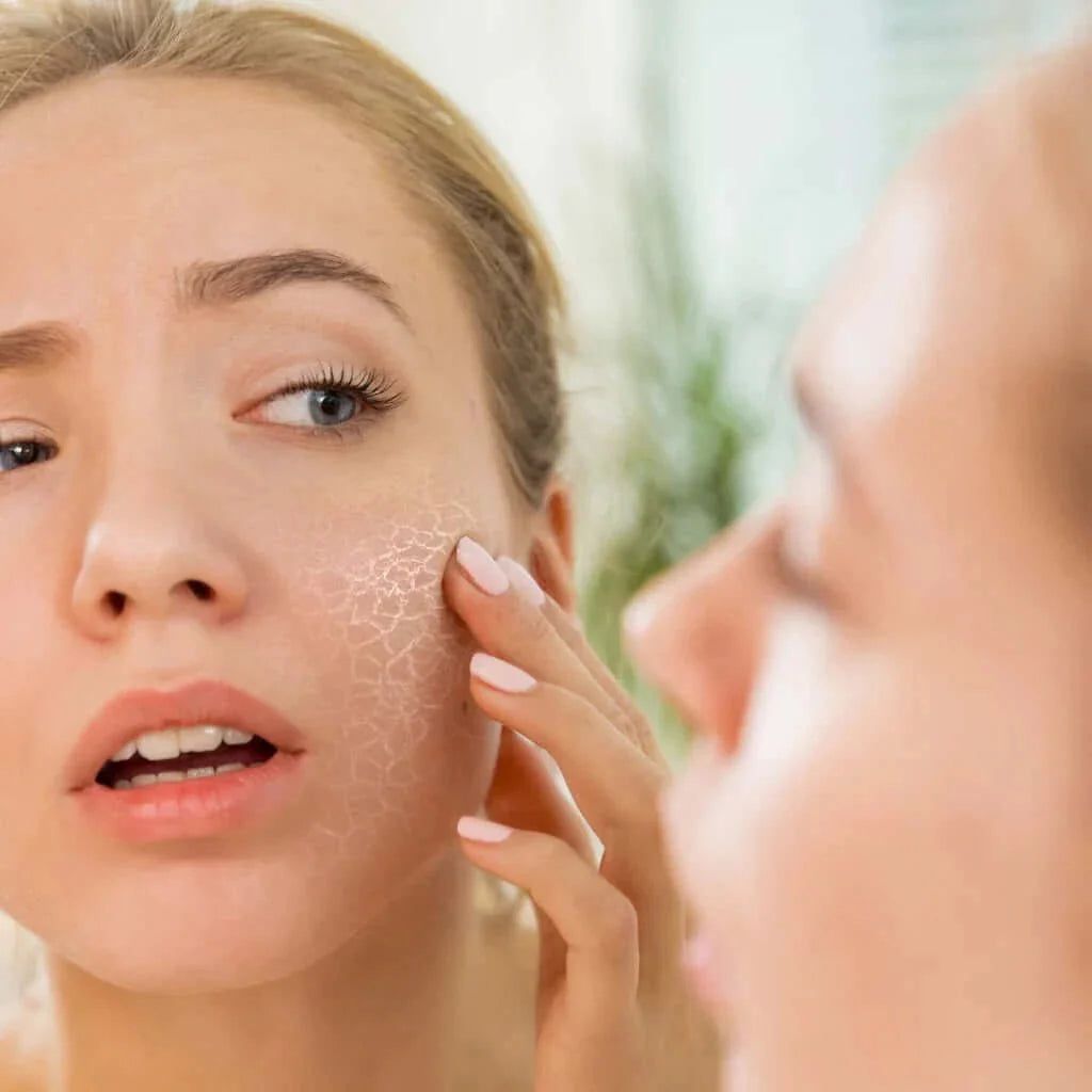 Shop Dehydrated Skin Korean Skincare - Lakinza K-beauty