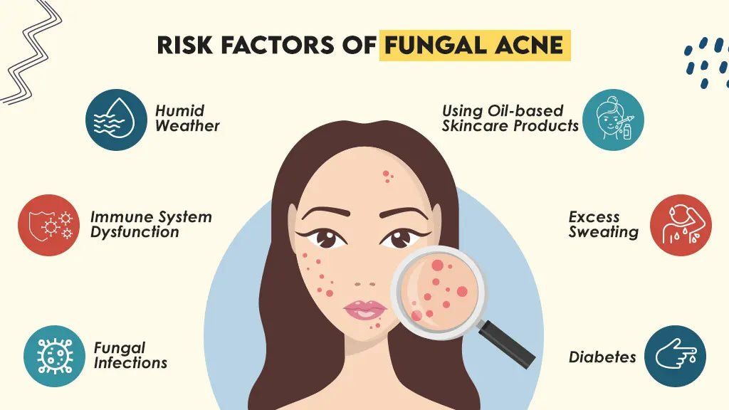 Shop Fungal Acne Safe Korean Skincare - Lakinza K-beauty