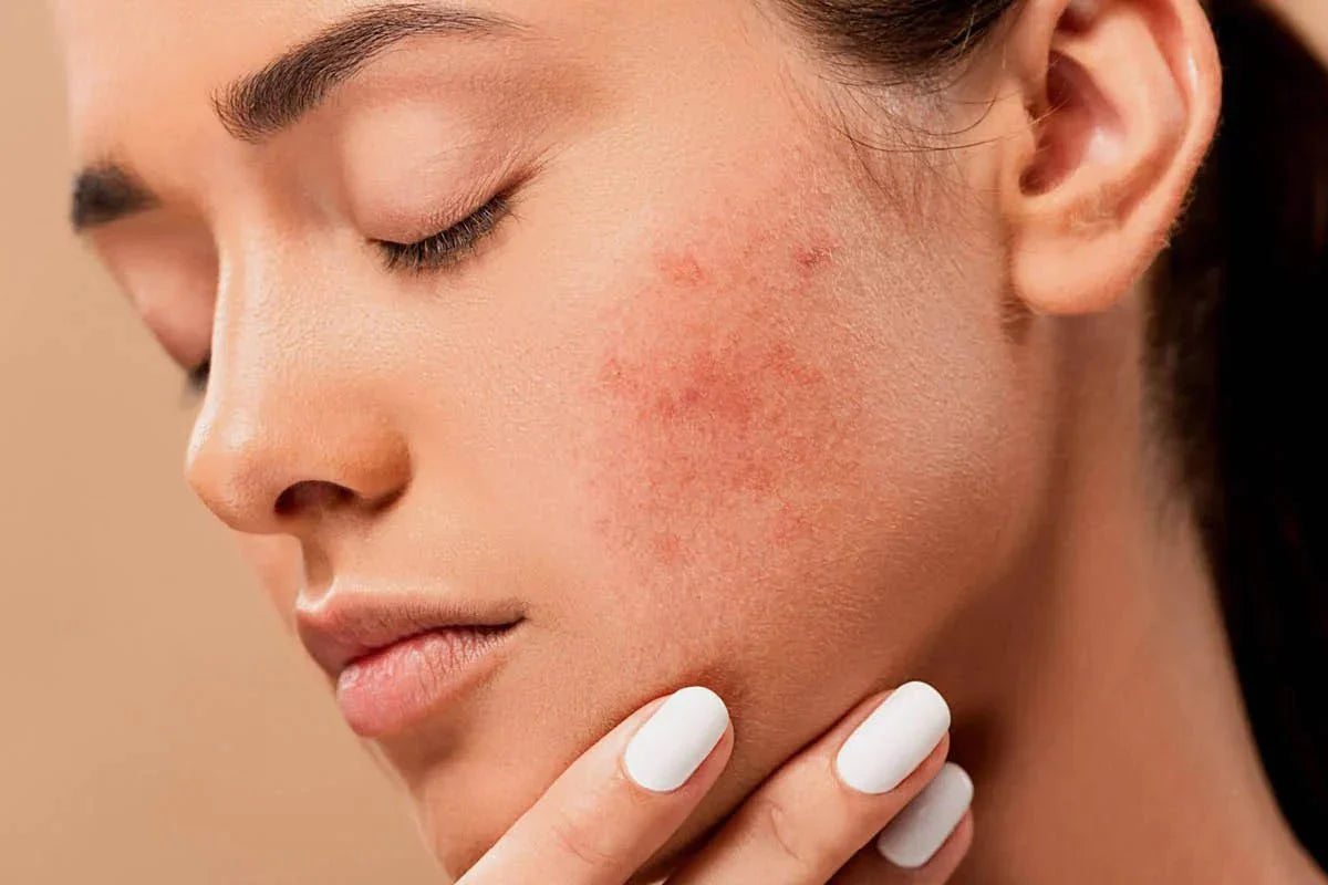 Shop Top Hypoallergenic Korean Skincare products in Canada