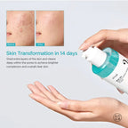 Anua Glass Skin 5-Step Skincare Routine (Upgraded)