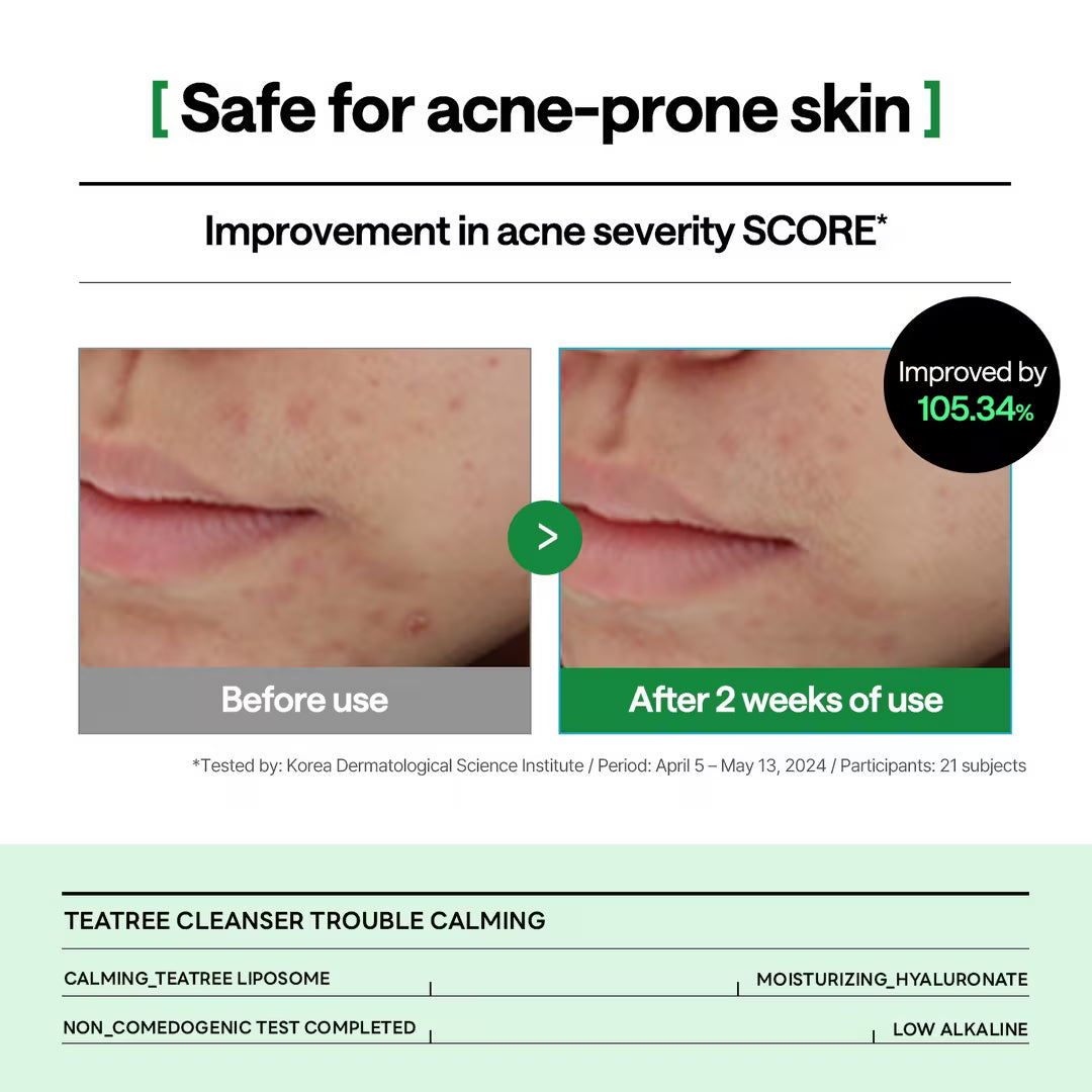 Mediheal Teatree Cleanser_Trouble Calming 120ml Lakinza K-beauty
