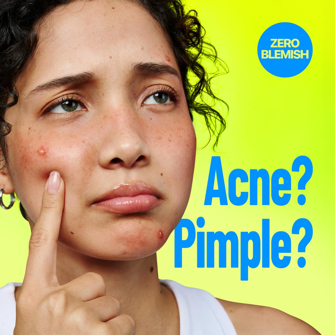 A close-up of a woman with visible acne and blemishes touching her cheek, with large blue text reading 'Acne? Pimple?' and a blue circular 'ZERO BLEMISH' logo on a bright yellow-green background.