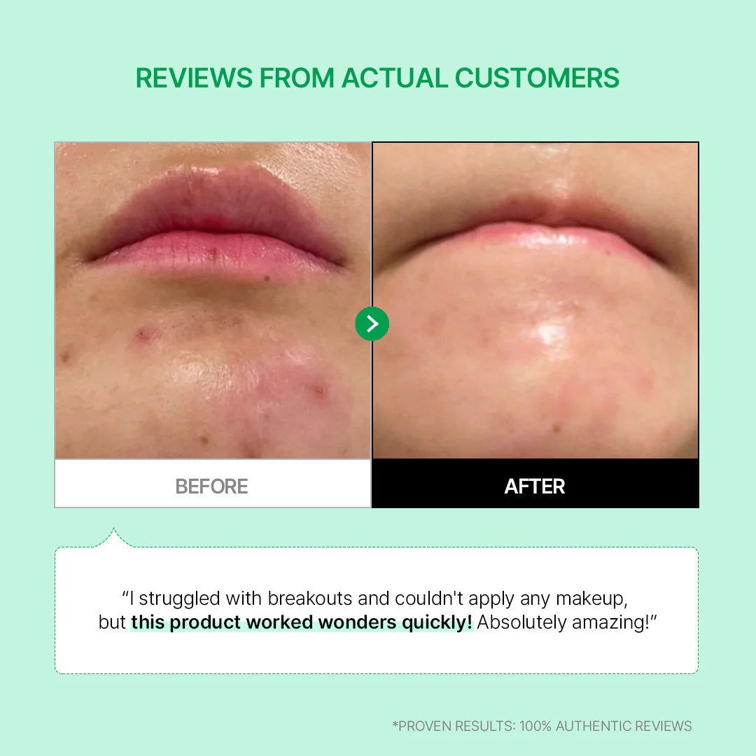 Parnell Cicamanu 92 Serum 30ml