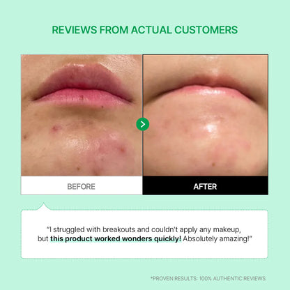 Parnell Cicamanu 92 Serum 30ml