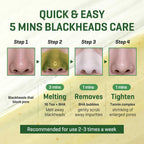 SOME BY MI Acne-Prone Skin Ultimate Skincare Routine