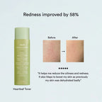 Abib Heartleaf Calming Toner Skin Booster 200ml | Lakinza K - beauty Canada