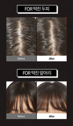 APIEU Oily Hair Dry Powder 5g | Lakinza K - beauty Canada