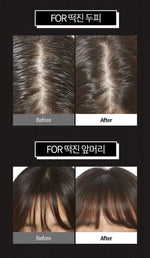 APIEU Oily Hair Dry Powder 5g Lakinza K-beauty