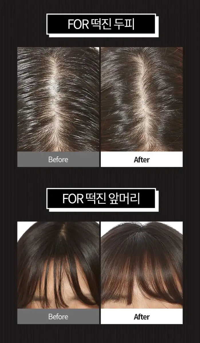 APIEU Oily Hair Dry Powder 5g Lakinza K-beauty