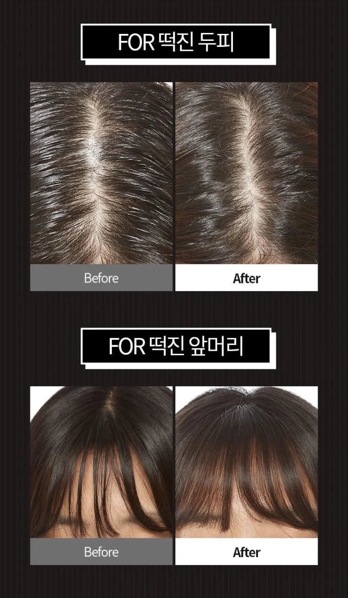 APIEU Oily Hair Dry Powder 5g | Lakinza K - beauty Canada