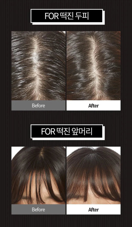 APIEU Oily Hair Dry Powder 5g | Lakinza K - beauty Canada