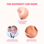 Atopalm Maternity Care Stretch Mark Cream 150ml Lakinza K-beauty