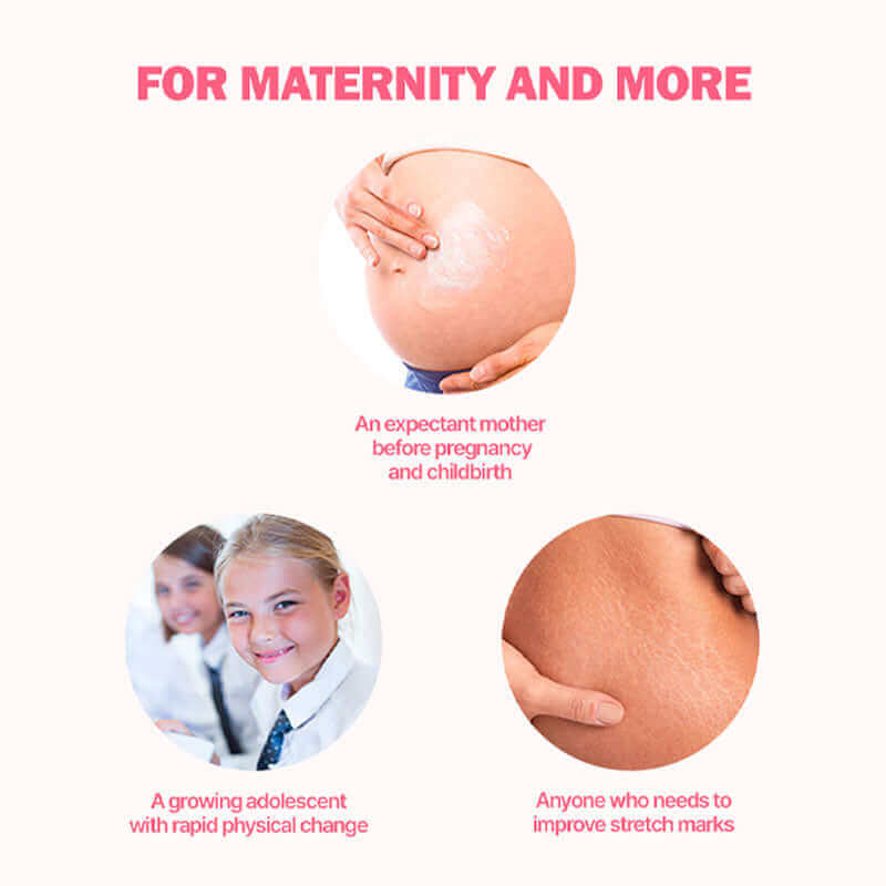 Atopalm Maternity Care Stretch Mark Cream 150ml Lakinza K-beauty