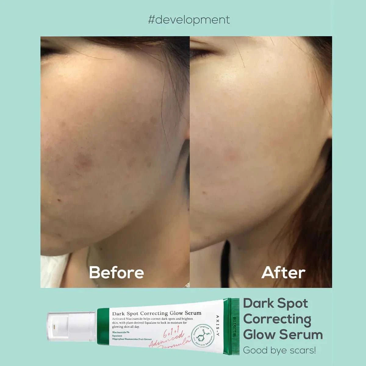 Axis-y Dark Spot Glow Serum 50ml Lakinza K-beauty
