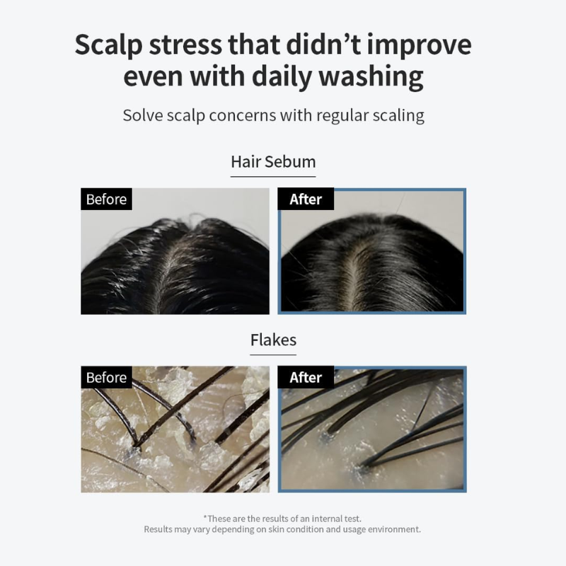GROWUS Sea Salt Therapy Scalp Scaler 120g-3