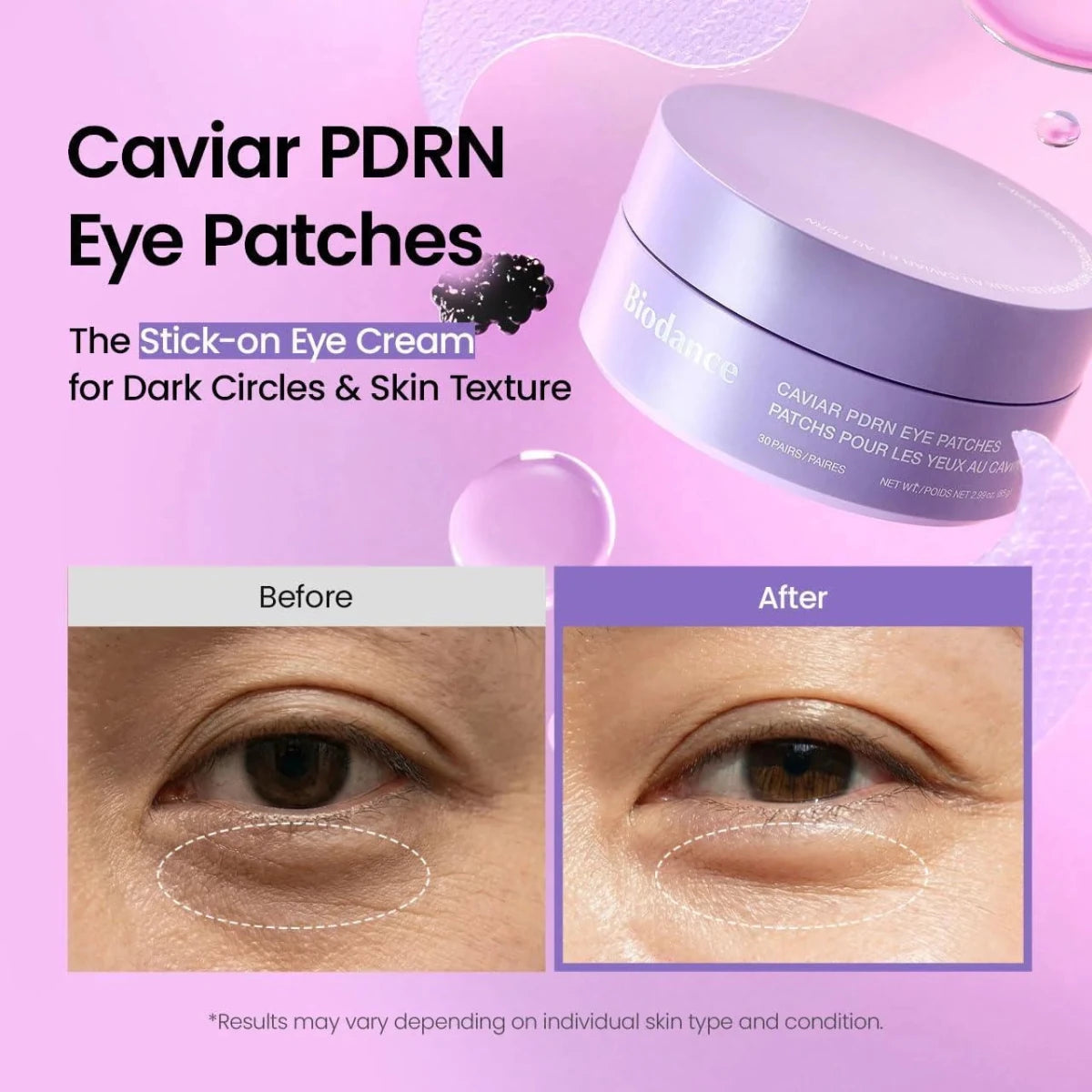 Biodance Caviar PDRN Eye Patches 30pcs | Lakinza K-beauty Canada