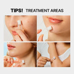 COSRX The AHA 2 BHA 2 Blemish Treatment Serum 120g Lakinza K-beauty