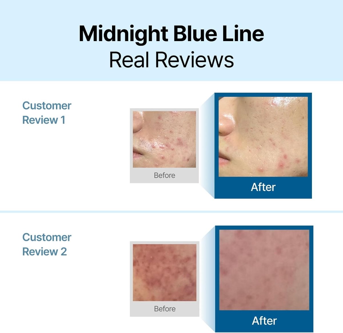 Dear, Klairs Midnight Blue Calming Cream 60ml Lakinza K-beauty