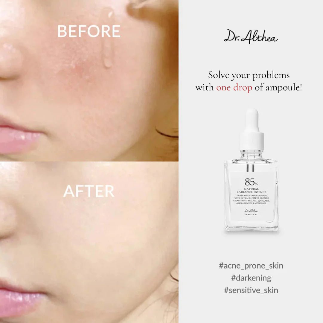 Dr.Althea Natural Radiance Essence 30ml | Lakinza K - beauty Canada