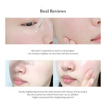 Dr.Althea Natural Radiance Essence 30ml Lakinza K-beauty