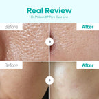 Dr.Melaxin Advanced Large Pores Tightening Skincare Routine | Lakinza K - beauty Canada