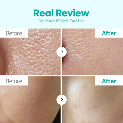 Dr.Melaxin Advanced Large Pores Tightening Skincare Routine | Lakinza K - beauty Canada