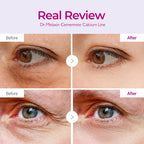 Dr.Melaxin Cemenrete Calcium Dark Spot Eye Cream 15g | Lakinza K - beauty Canada
