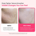 Dr.Melaxin Cemenrete Cyano Pink Spicule Serum 30ml | Lakinza K - beauty Canada