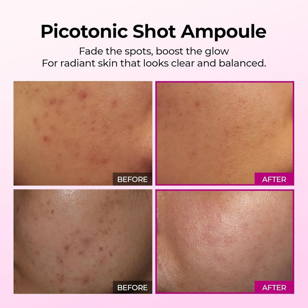 Dr.Melaxin Cemenrete Picotonic Shot Ampoule 30ml | Lakinza K - beauty Canada