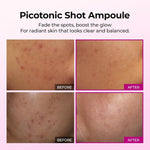 Dr.Melaxin Cemenrete Picotonic Shot Ampoule 30ml Lakinza K-beauty